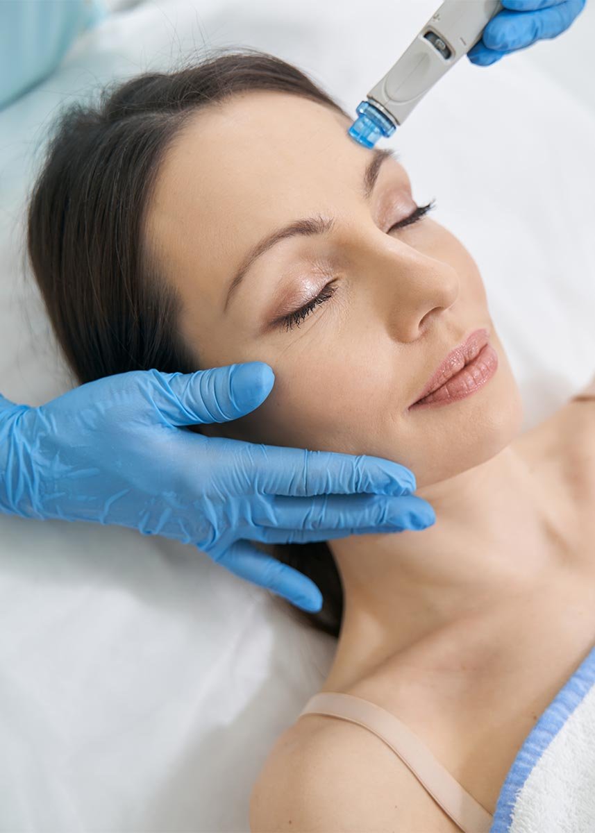 Microneedling at Syno Health